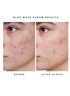HERBIVORE HERBIVORE Blue Besties Duo – 2-Step Treatment for Acne-Prone Skin, Aquarius Cleanser (50 mL) & Blue Wave Serum (10 mL), Plant-Based, Vegan, Cruelty-Free  - Image 2