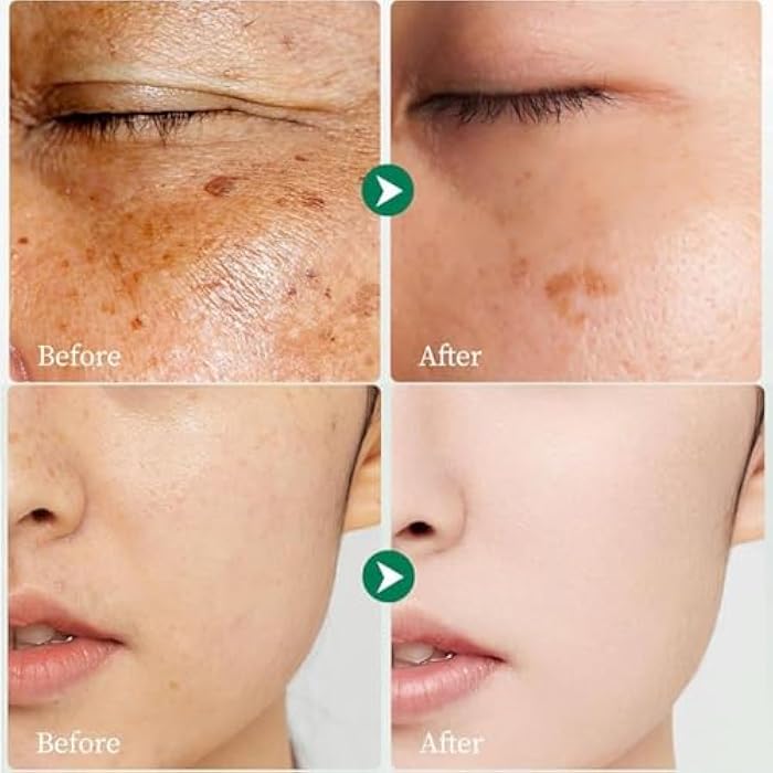 Crema para Manchas Oscuras en La Cara, Cremas para Quitar Manchas de La Cara, Crema para Las Manchas de La Cara, 50 ML / 1.7 FLOZ - Image 5