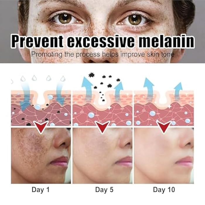 Crema para Manchas Oscuras en La Cara, Cremas para Quitar Manchas de La Cara, Crema para Las Manchas de La Cara, 50 ML / 1.7 FLOZ - Image 4