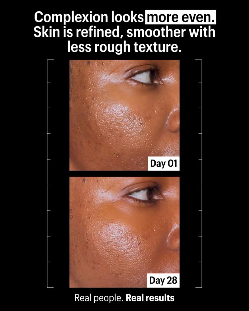 Allies of Skin Promise Keeper Blemish Sleeping Facial: Night Cream Moisturizer Treatment. Dioic + Mandelic + Lactic Acid, Manuka Honey, Rosehip Oil. Hydrates & Refines Skin 1.7 oz - Image 3