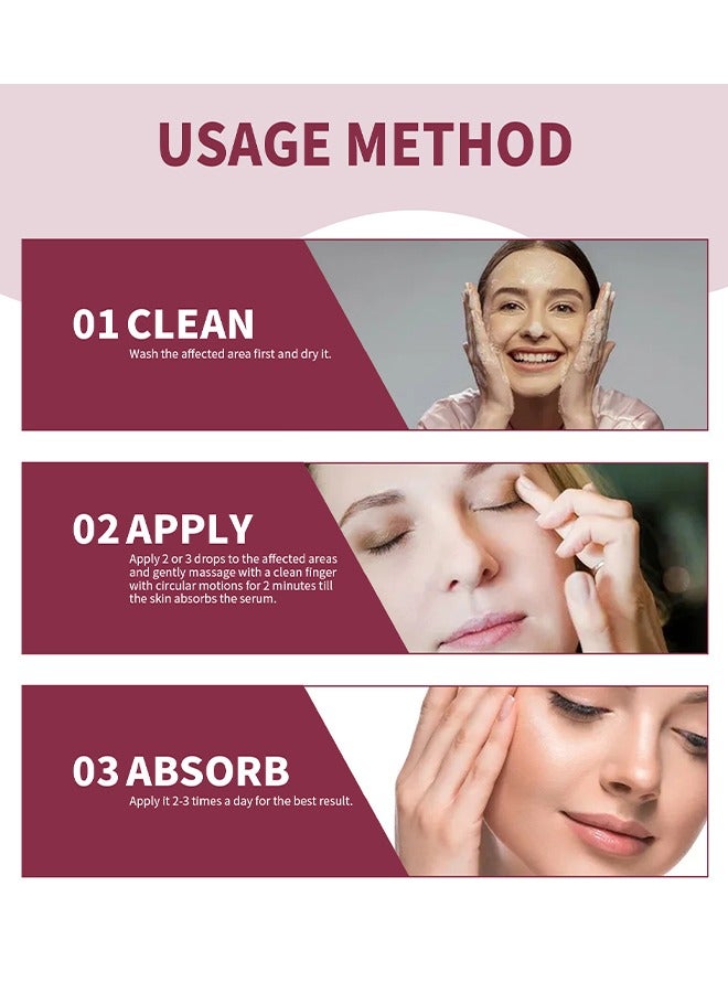 Jaysuing Stye Eye Relief Serum, Stye Eye Treatment, Eye Stye Remover, Chalazion Remover, Stye Eye Relief Serum for Styes Chalazion and Blepharitis Treatment, Eye Care, Mild Lash and Eye Cleanser 30ml - Image 5