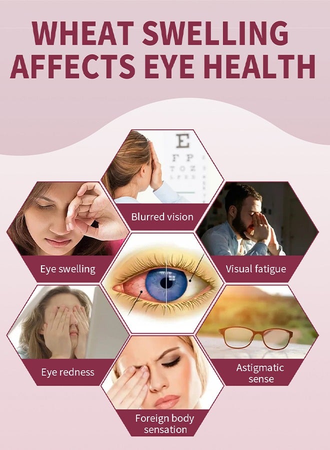 Jaysuing Stye Eye Relief Serum, Stye Eye Treatment, Eye Stye Remover, Chalazion Remover, Stye Eye Relief Serum for Styes Chalazion and Blepharitis Treatment, Eye Care, Mild Lash and Eye Cleanser 30ml - Image 4