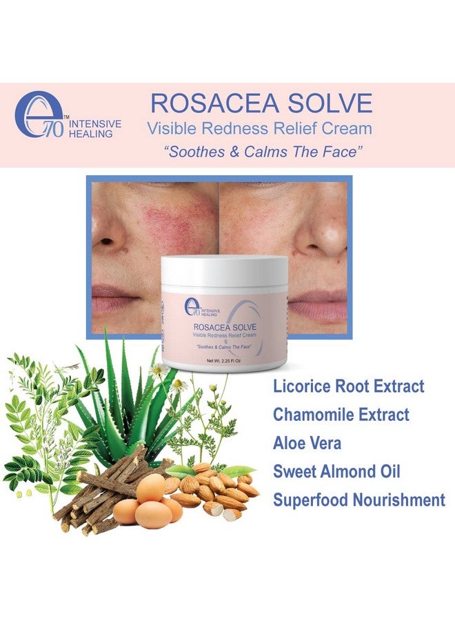 e70 70 Rosacea Solve Redness Relief Cream Face Moisturizer For Rosacea & Acne Prone Skin Sensitive Skin Care With Organic Ingredients Almond Oil Licorice & Chamomile Extracts No Parabens - Image 3