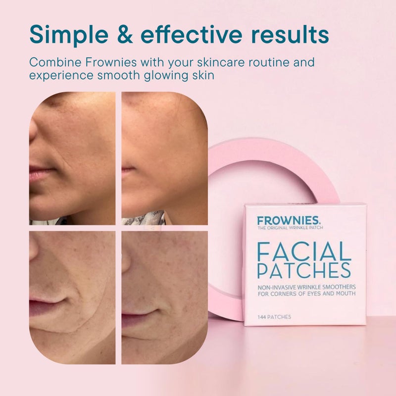 Frownies Facial Patches for Wrinkles on the Corner of Eyes & Mouth - Hypoallergenic Anti-Wrinkle Face Tape - Wrinkle Patch to Smooth & Soften Crow’s Feet & Smile Lines - For Overnight Use, 144 Patches - Image 4
