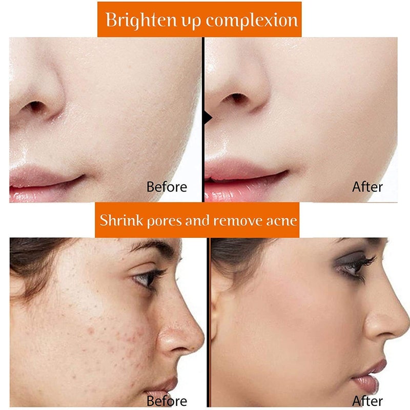 Quat Quat Vitamin C And E Face Serum For AntiAgeing Daily Care AntiTan Blemish Removal Cleans Skin Pores Skin Brightening Radiance Glow Spot Removal Pigmentation Removal 30ml  - Image 2