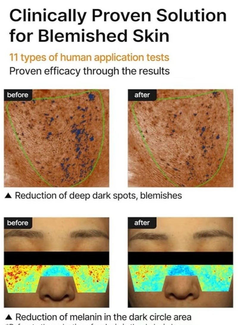 سيليماكس المسام والبقعة الداكنة مشرقة كريم, المسام الحد الأدنى, ترطيب للبشرة الحساسة, كريم الاستخدام اليومي - Image 3