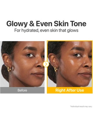 No.5 Serum | Glutathione Vitamin Concentrated Serum | Glutathione, Vitamin C, Tranexamic Acid | Hyperpigmentation, Acne Scars | Suitable for Sensitive Skin, Korean Skincare | 1.01 fl. oz. - view 5
