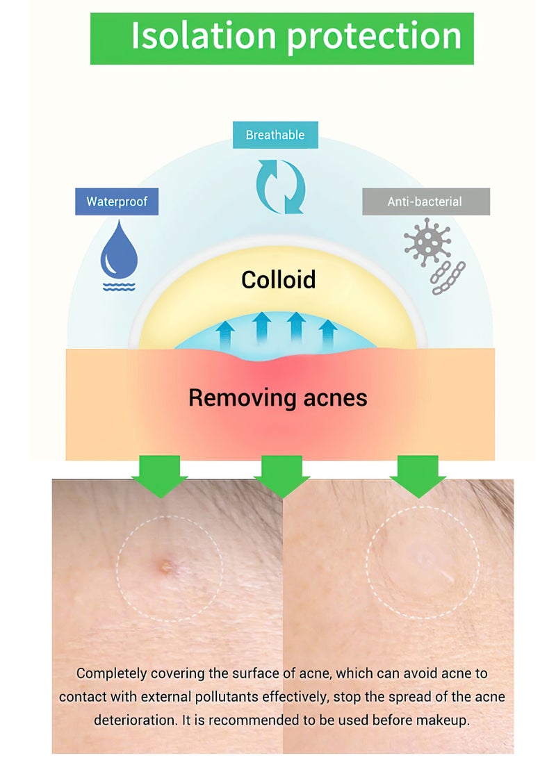 Breylee 0.3mm 22pcs Invisible Tea Tree Acne Patch for Night Use - Image 5