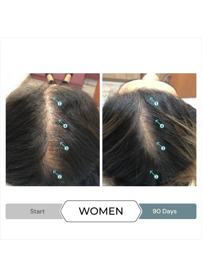 DS LABORATORIES Revita.SOD Hair Growth Supplement by DS Laboratories - Experience Fuller, Thicker, Stronger Hair, Combat Hair Loss and Hair Thinning Caused by Stress, Reduce Hair Thinning, Balding, and Hair Shedding  - Image 2