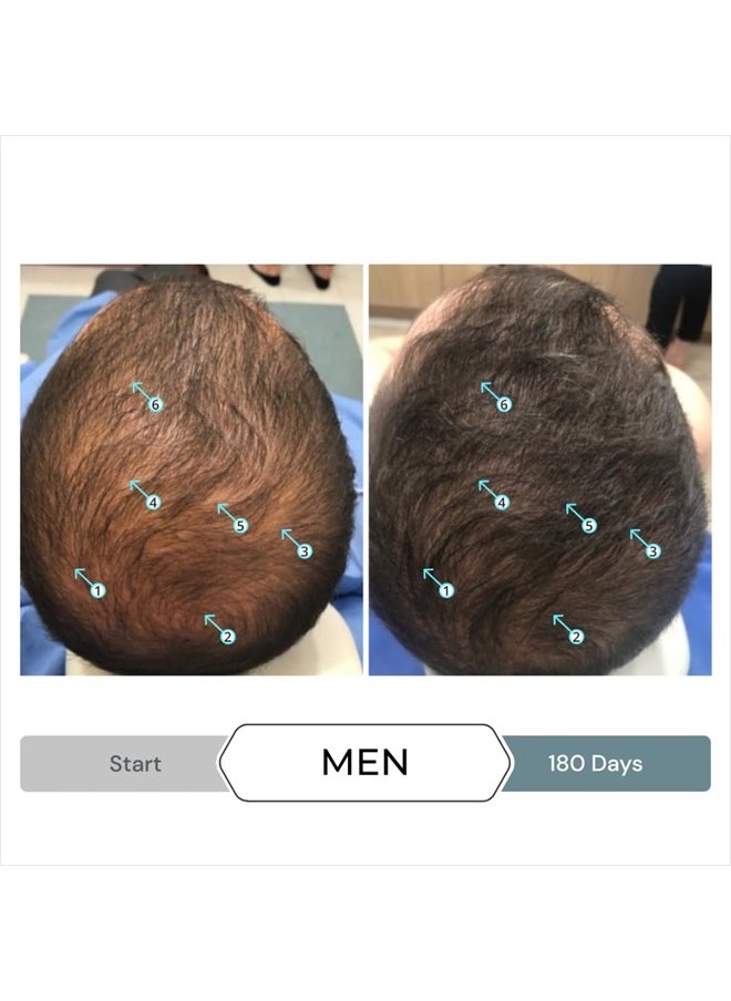 DS LABORATORIES Revita.SOD Hair Growth Supplement by DS Laboratories - Experience Fuller, Thicker, Stronger Hair, Combat Hair Loss and Hair Thinning Caused by Stress, Reduce Hair Thinning, Balding, and Hair Shedding  - Image 3