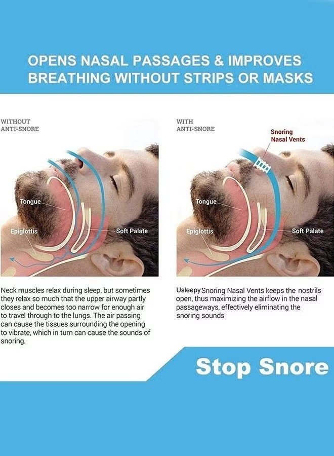 8 Pieces Anti Snoring Devices, Nasal Dilator snoring nose vents Stopper for Travel and Home - Image 4