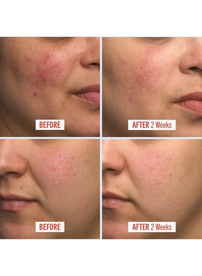 First Aid Beauty كريم الإصلاح الفائق ترطيب مكثف للوجه والجسم – 1 أونصة - Image 3