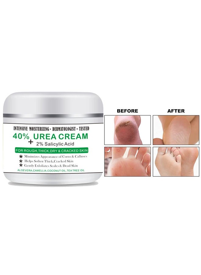 Crazylife 40% Urea Cream and 2% Salicylic Acid, Moisturizing Hand and Foot Cream for Chapped Chapped Hands, Softening and Thickening of the Skin, Hand and Foot Exfoliation Moisturizing Cream - 100g ﻿  - Image 2