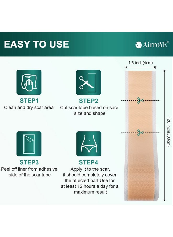 AirroYE - Silicone Scar Sheets,Silicone Scar Tape(1.6"X 120" Roll-3M), Reusable And Effective Scar Removal Sheets, Silicone Scar Removal Sheets For Surgical Scars,Healing Keloid, C-Section, Tummy Tuck - Image 1