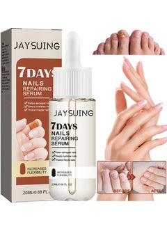 7Days Nails Repairing Serum, Nail Nutrient Oil Strengthener Oil Serum Nail Growth Oil, Nail Cuticle Oil Strengthener, Nail Serum For Growth And Repair For Damaged Nails, 20ML