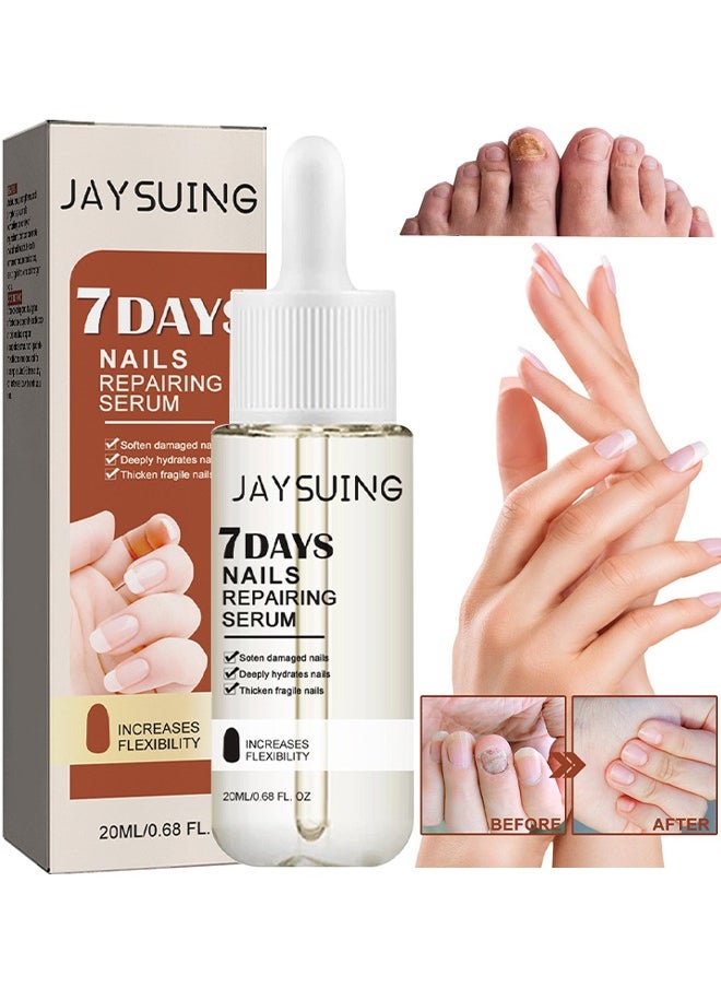 Jaysuing - 7Days Nails Repairing Serum, Nail Nutrient Oil Strengthener Oil Serum Nail Growth Oil, Nail Cuticle Oil Strengthener, Nail Serum For Growth And Repair For Damaged Nails, 20ML - Image 1