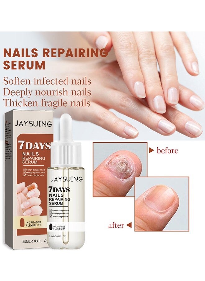 Jaysuing - 7Days Nails Repairing Serum, Nail Nutrient Oil Strengthener Oil Serum Nail Growth Oil, Nail Cuticle Oil Strengthener, Nail Serum For Growth And Repair For Damaged Nails, 20ML - Image 1