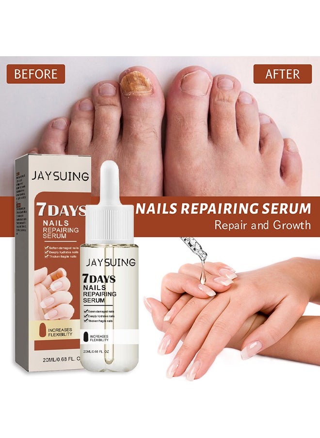Jaysuing - 7Days Nails Repairing Serum, Nail Nutrient Oil Strengthener Oil Serum Nail Growth Oil, Nail Cuticle Oil Strengthener, Nail Serum For Growth And Repair For Damaged Nails, 20ML - Image 1