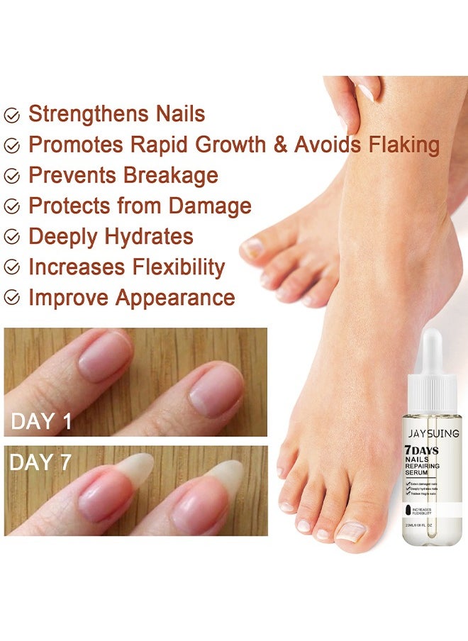 Jaysuing - 7Days Nails Repairing Serum, Nail Nutrient Oil Strengthener Oil Serum Nail Growth Oil, Nail Cuticle Oil Strengthener, Nail Serum For Growth And Repair For Damaged Nails, 20ML - Image 1
