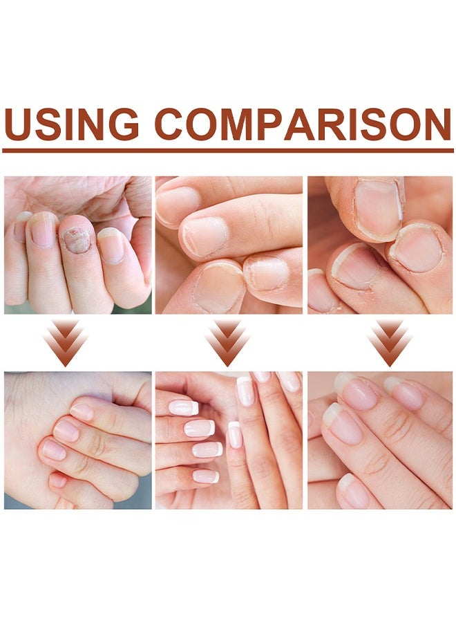 Jaysuing - 7Days Nails Repairing Serum, Nail Nutrient Oil Strengthener Oil Serum Nail Growth Oil, Nail Cuticle Oil Strengthener, Nail Serum For Growth And Repair For Damaged Nails, 20ML - Image 1