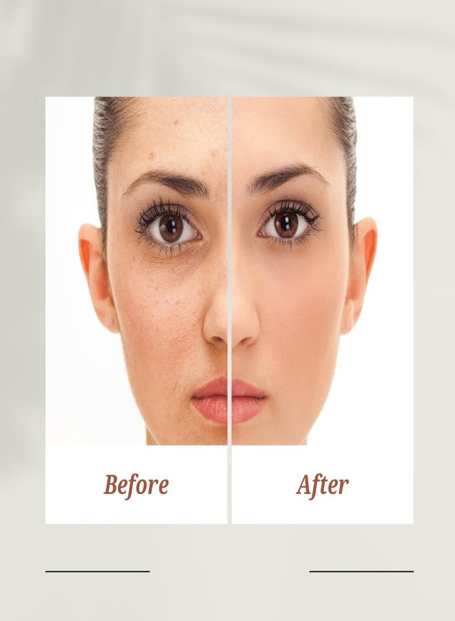 Emerge Professional Dark Spot Corrector Serum – Fade Dark Spots, Hyperpigmentation & Acne Scars – Brightening Serum with Vitamin C, Niacinamide & Vitamin E - Image 4