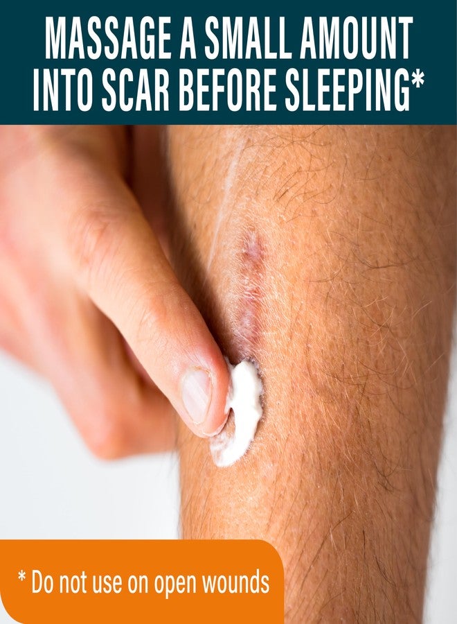 Nuvadermis كريم نوفاديرميس المكثف للندبات ليلاً مع الريتينول، الألانطوين، فيتامين E، البيتين - 1.35 أونصة سائلة علاج كريم الندبات لعمليات القيصرية، الكيلويد ورعاية ما بعد الجراحة - Image 3