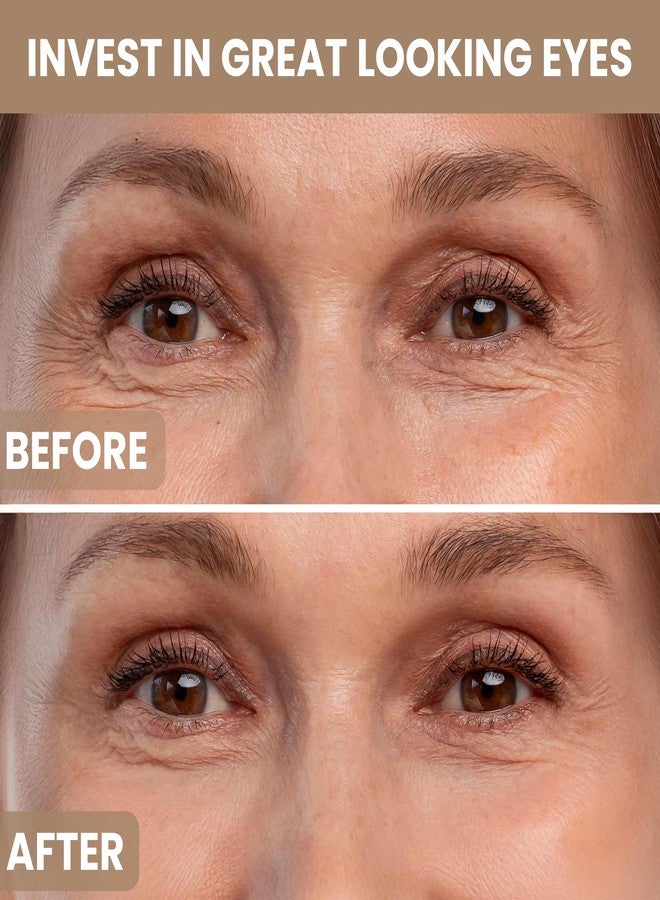 M.D. Blend Plant Stem Cell Eye Serum Complex | Aloe Vera, Vitamin C | Hydrating Eye Treatment | Airless Pump - 15ml - Image 5