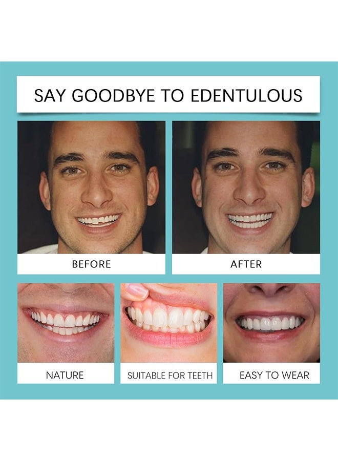 Snap-Fit on Dentures Are Adjustable, Comfortable and Natural, and Come With Braces to Correct Gaps Between Teeth - Image 5