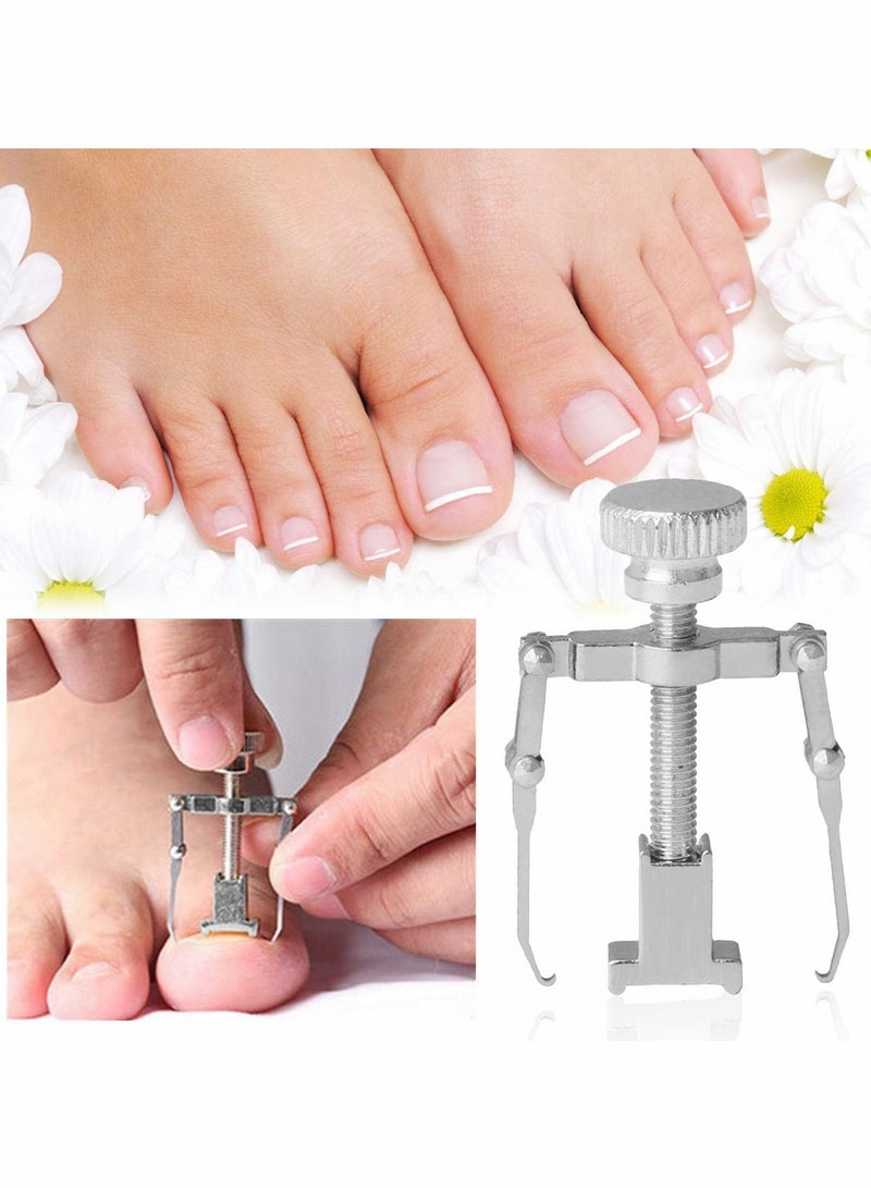 Excefore lngrown Toenail Treatment Kit, 2Pcs Professional Ingrown Toe Nail Recover Correction Tool, Pedicure Tools for Nail Correction, Softening and Easy Trimming - Image 5