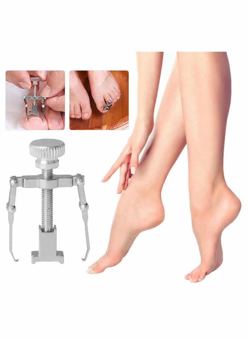 Excefore lngrown Toenail Treatment Kit, 2Pcs Professional Ingrown Toe Nail Recover Correction Tool, Pedicure Tools for Nail Correction, Softening and Easy Trimming - Image 2