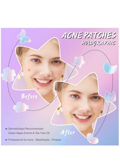 Elaimei 84 Pieces Holographic Acne Patches Easy to Use Quick Healing Pain and Scar Free Patches for Face Promotes Wound Healing Natural Formula Cute Pimple Patches for Women  - Image 5