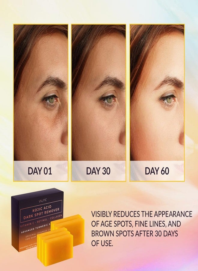 VALITIC Kojic Acid Dark Spot Remover Soap Bars with Vitamin C, Retinol, Collagen, Turmeric - Original Japanese Complex Infused with Hyaluronic Acid, Vitamin E, Shea Butter, Castile Olive Oil - 5 Pack - Image 2