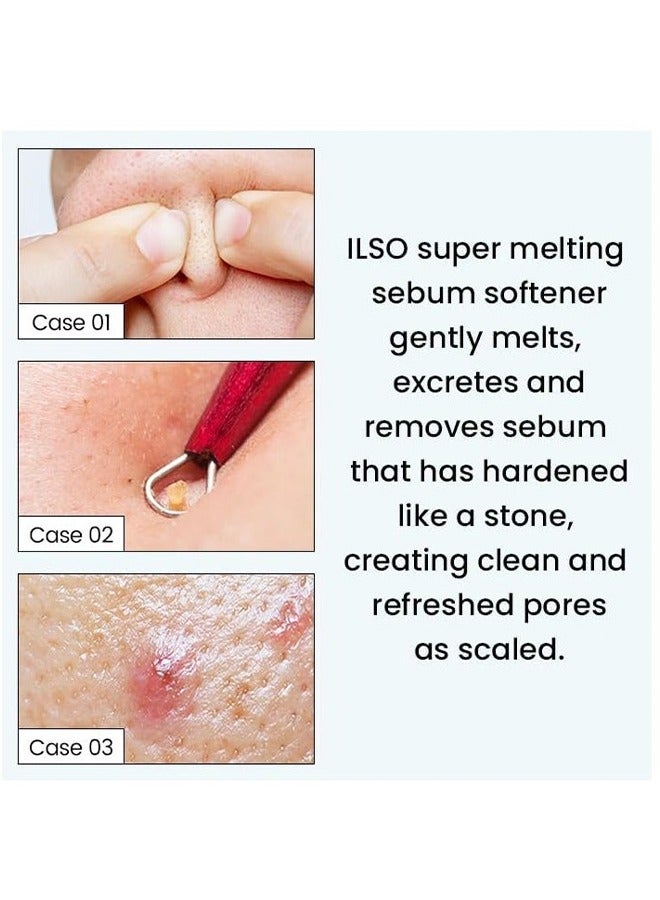 ilso Melting Sebum Softener -  Pore Cleansing Solution, Melts Away Blackheads & Sebum, Korean Skincare 150g - Image 4