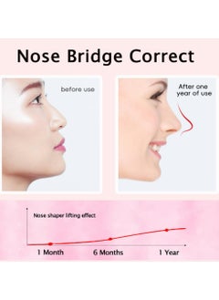 Generic Nose Shaper Clip,Nose Straightener for Wide Noses,Safety Silicone Nose Beautifier  - Image 2
