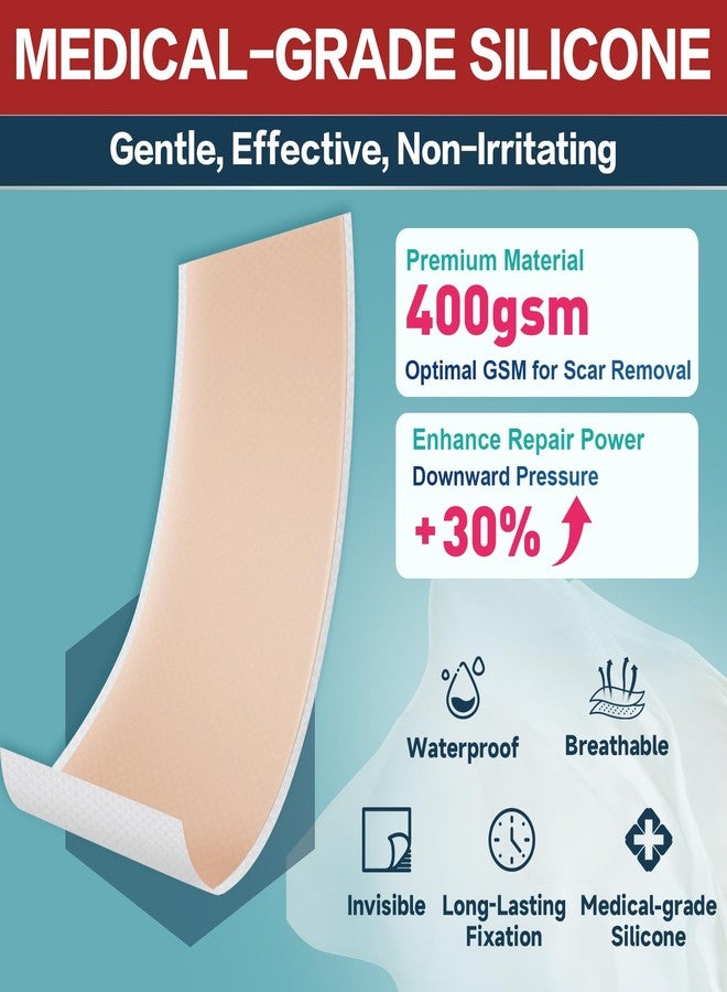 kindshine Silicone Scar Tape (1.6"x240"-6M,Silicone Scar Sheets for Scar Removal Treatment,Silicone Scar Removal Strips for Surgical,C-Section,Tummy Tuck,Keloid Scars - Image 3