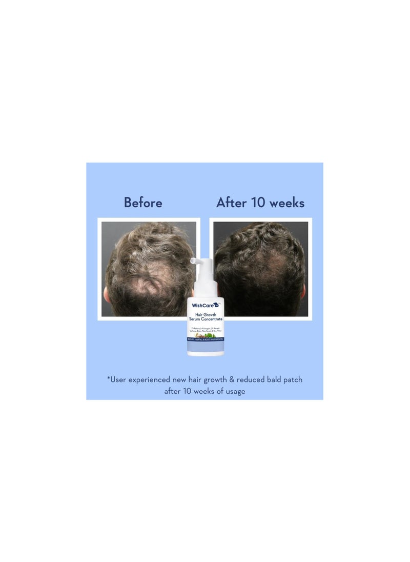 WishCare - WishCare Hair Growth Serum Concentrate - 3% Redensyl, 4% Anagain, 2% Baicapil, Caffeine, Biotin & Rice Water - Rosemary Hair Serum for Hair Fall Control & Hair Growth 30ml - Image 1