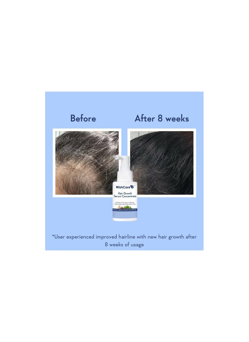 WishCare - WishCare Hair Growth Serum Concentrate - 3% Redensyl, 4% Anagain, 2% Baicapil, Caffeine, Biotin & Rice Water - Rosemary Hair Serum for Hair Fall Control & Hair Growth 30ml - Image 1