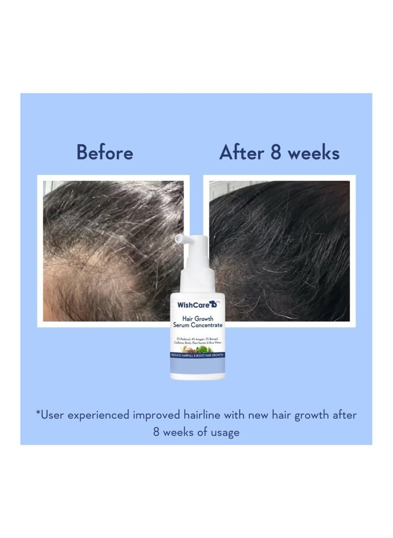 WishCare - WishCare Hair Growth Serum Concentrate - 3% Redensyl, 4% Anagain, 2% Baicapil, Caffeine, Biotin & Rice Water - Rosemary Hair Serum for Hair Fall Control & Hair Growth 30ml - Image 1
