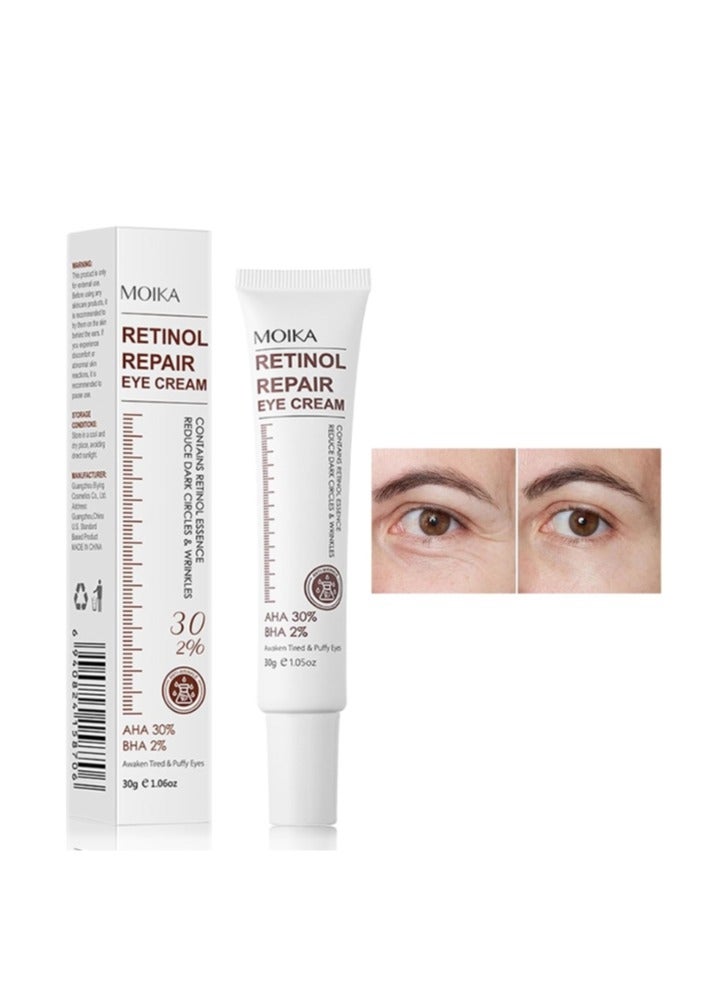 MOIKA Magic Retinol Eye Cream for Puffiness and Bags Under Eyes, Instant Results Firm Eye Tightener Anti Aging Under Eye Cream for Men Women, Reduce Fine Lines Wrinkles and Age Spots 30g - Image 1