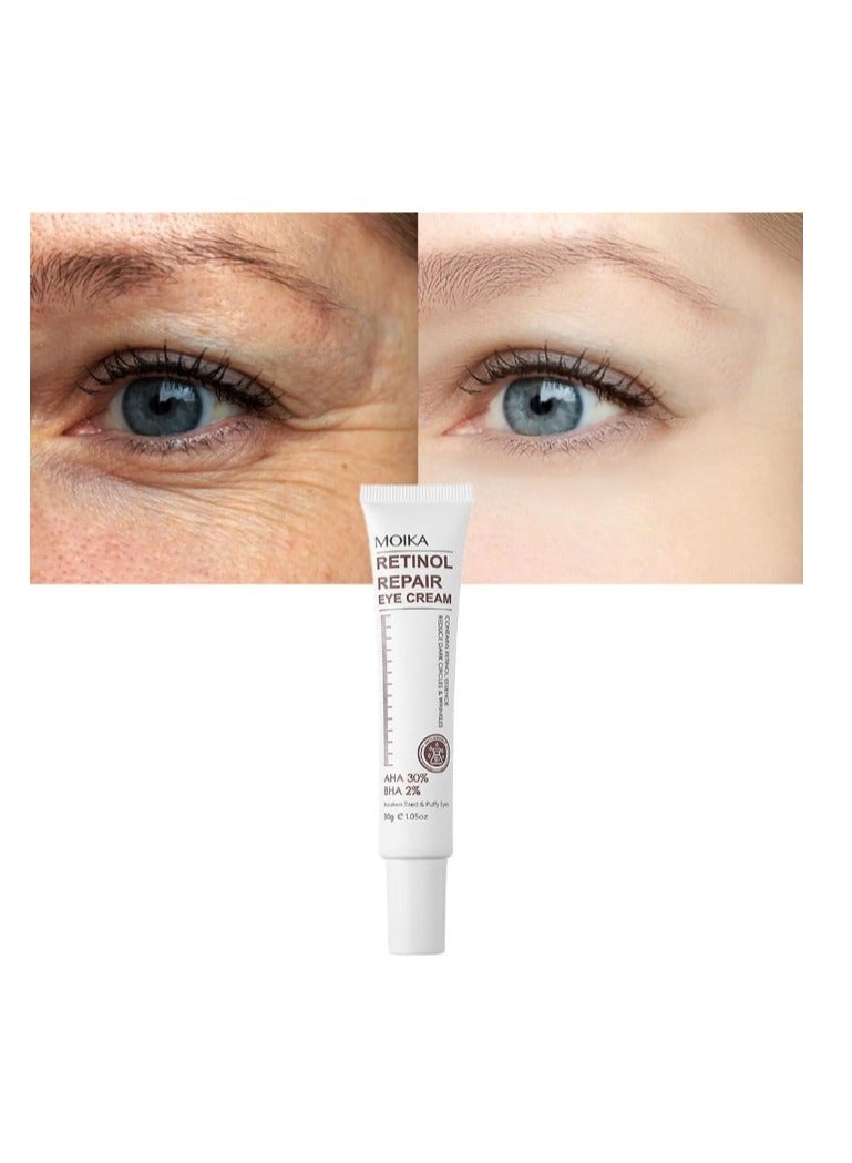 MOIKA Magic Retinol Eye Cream for Puffiness and Bags Under Eyes, Instant Results Firm Eye Tightener Anti Aging Under Eye Cream for Men Women, Reduce Fine Lines Wrinkles and Age Spots 30g - Image 3