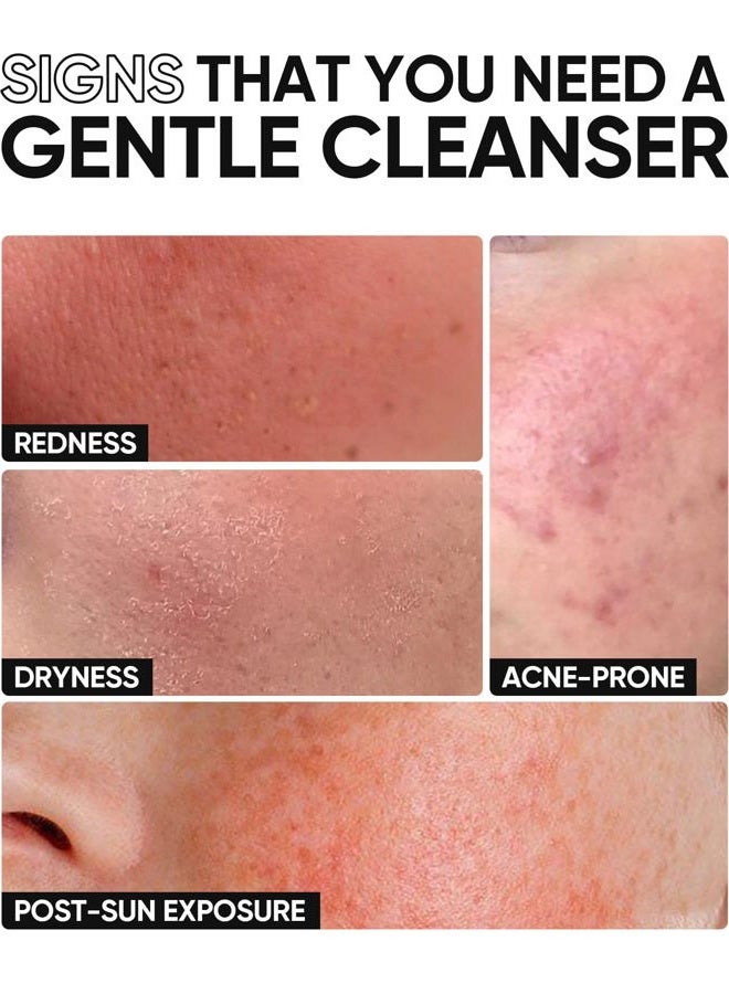 SKINTIFIC 5X Ceramide Low pH Facial Cleanser, Gentle Hydrating Face Wash with Hyaluronic Acid, Daily Face Wash for Dry to Normal Skin, Sensitive Skin Tested, Not Tight, Fragrance Free - Image 3