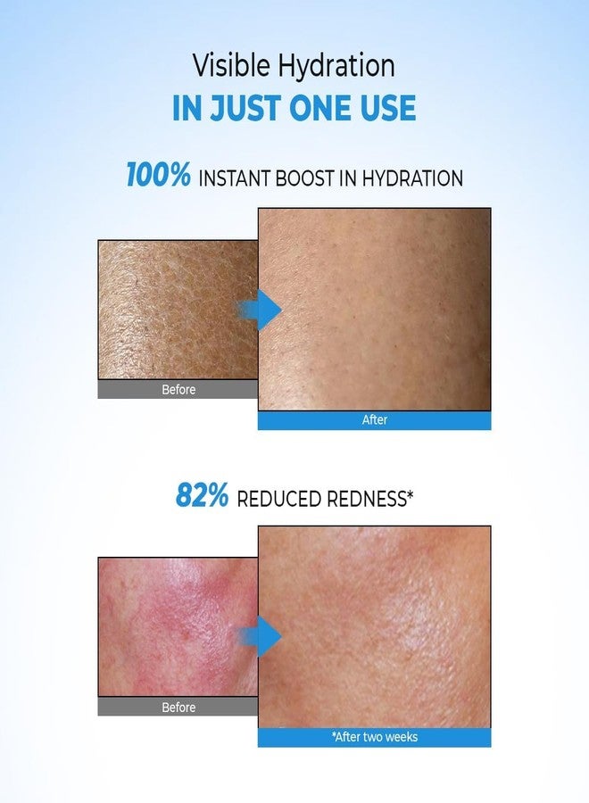 Conscious Chemist Hyaluronic Acid Moisturizer, for Dry Skin Face, Ceramide Moisturizer, Face Cream for Men & Women, Dehydrated Skin, For Normal to Dry Skin - Hydro+ (Pack of 2) - Image 3