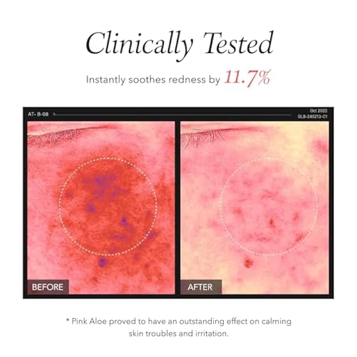 APRILSKIN Pink Aloe Facial Polish Cleanser | Gentle Exfoliation with Mungbean & Soybean Scrub | Removes Waterproof Makeup & Sunscreen | Non-Comedogenic Cleanser for All Skin Types | Korean Skincare - Image 4