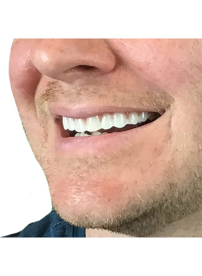Instant Smile Instant Smile Comfort Fit Flex - Natural Shade - Upper Veneer Cosmetic Teeth  - Image 3