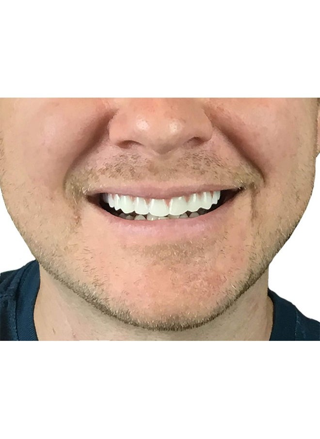 Instant Smile Instant Smile Comfort Fit Flex - Natural Shade - Upper Veneer Cosmetic Teeth  - Image 2
