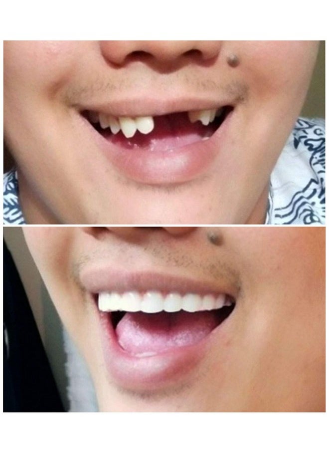 Instant Smile Instant Smile Comfort Fit Flex - Natural Shade - Upper Veneer Cosmetic Teeth  - Image 5