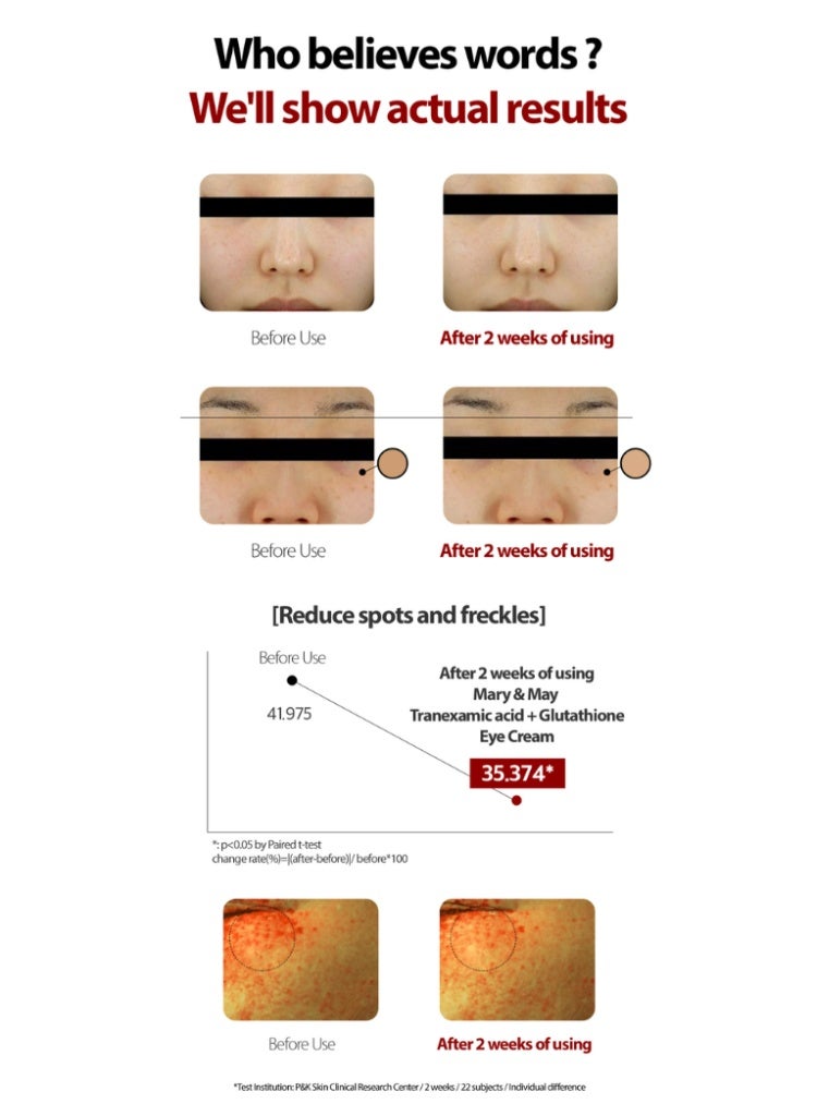 MARY & MAY Mary&May Tranexamic Acid + Glutathione Eye Cream 30g – Brightening & Anti-Dark Circles - Image 3