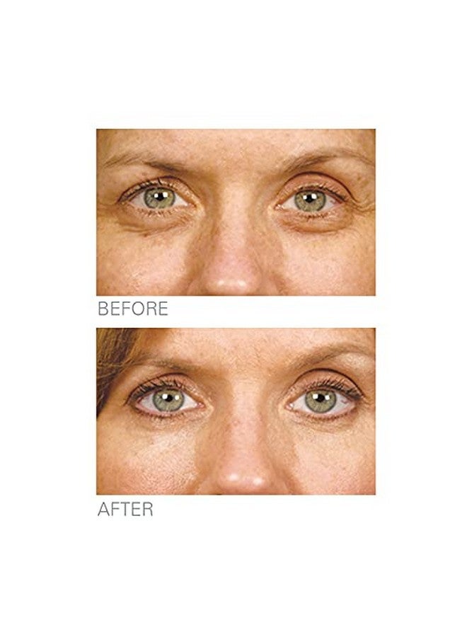 Biologic Solutions Stem Cell Therapy Eye Repair With Retinoid 160 Reduces The Appearance Of Fine Lines And Wrinkles By Supporting New Skin Growth And Encouraging Collagen Growth Via Timerelease Retinol - Image 2