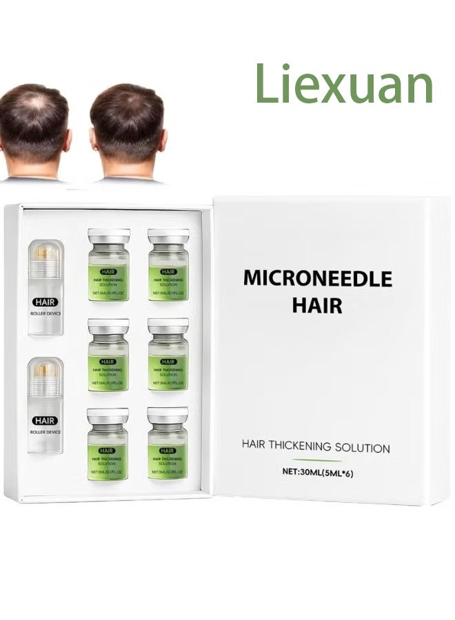Liexuan Alphainfuse Hair Regrowth System, Advanced Hair Growth Treatment Serum for Thicker, Fuller Hairs, Strengthens Roots, Gentle Painless, Supports Healthy Hairs Growth for Men & Women (1Pcs) - Image 1