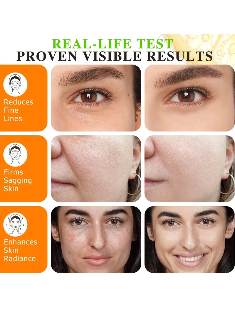 ATOANY - 60ml 20% Vitamin C Serum with Vitamin E and Ferulic Acid Serum for Face and Neck Boost Skin Collagen Hydrate and Plump Skin Reduce Fine Lines Anti Aging and Wrinkle Facial Serum - Image 1